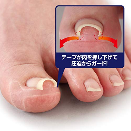 透明巻き爪テープ ミエーヌ 3