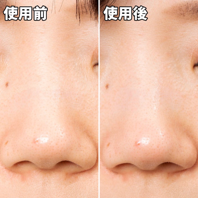 毛穴さわやか黒いパックを他商品と比較 口コミや評判を実際に使ってレビューしました Mybest