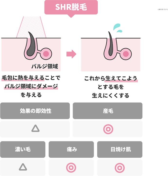 「SHR」は産毛にも反応し、日焼け肌にも施術可能