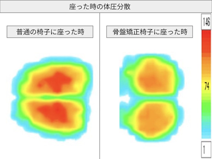 体圧分散性の高さ
