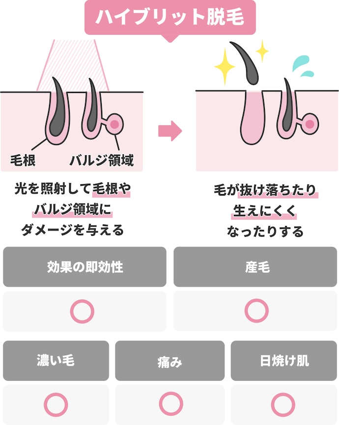 「HHR(ハイブリッド脱毛)」はIPLとSHRのいいところ取り