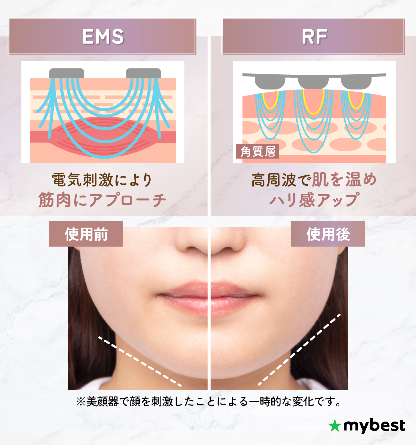 顔ハリをupする器械です。 【公式通販】