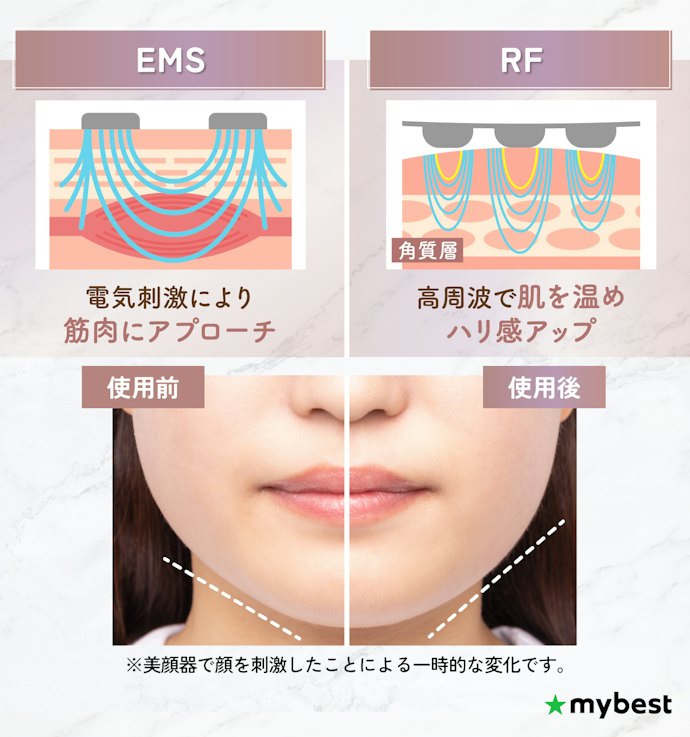 もたつきケアにはEMS、ハリ感アップにはRF付きのリフトアップ美顔器がおすすめ