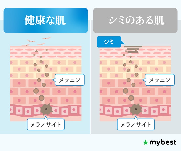 【シミ】メラニンの生成が主な原因