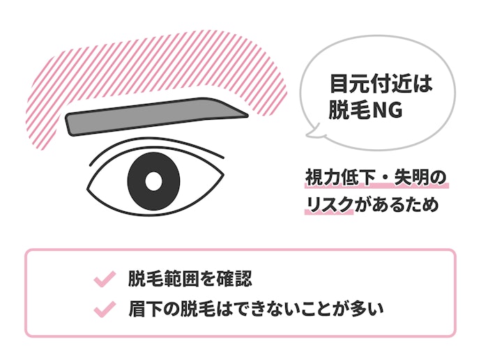脱毛範囲をチェック。サロンやクリニックによっては範囲が狭いことも
