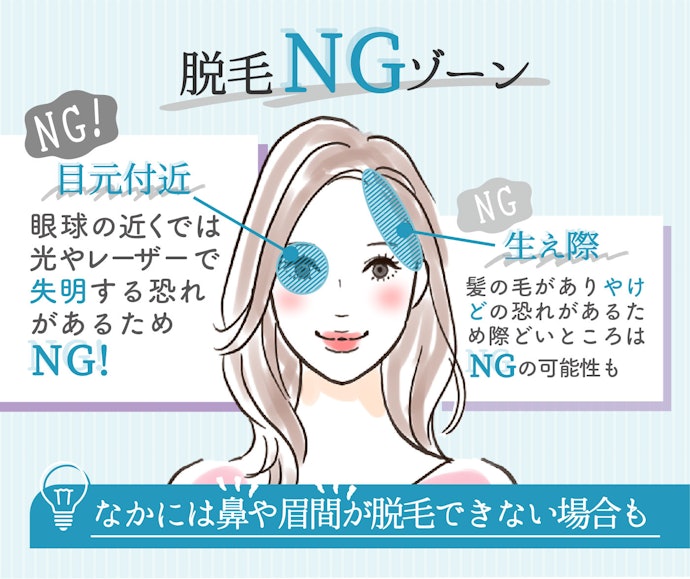 脱毛できない部位がある