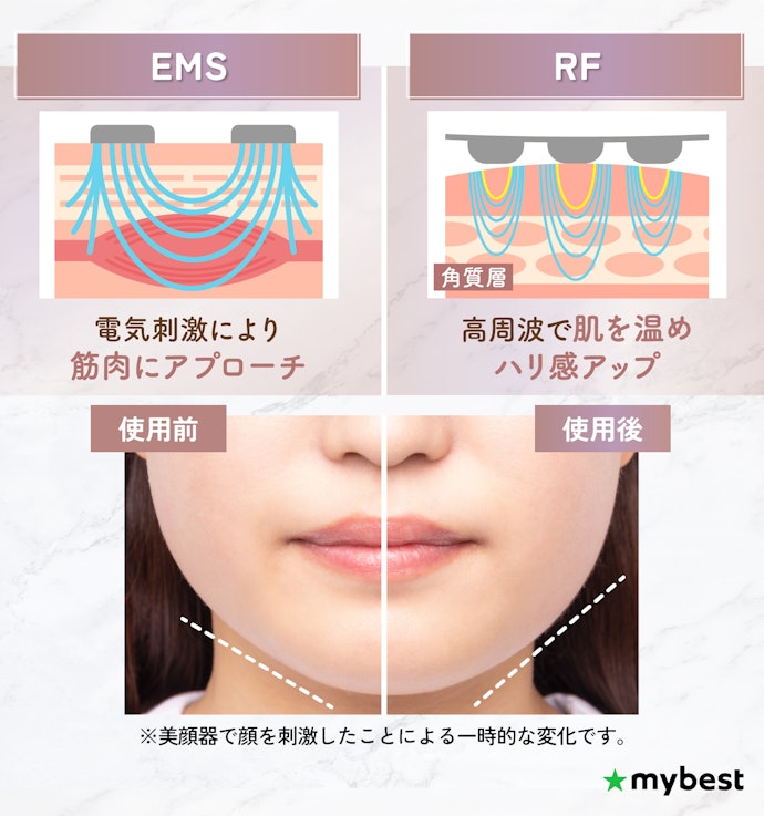 もたつきケアにはEMS、ハリ感アップにはRF付きのリフトアップ美顔器がおすすめ