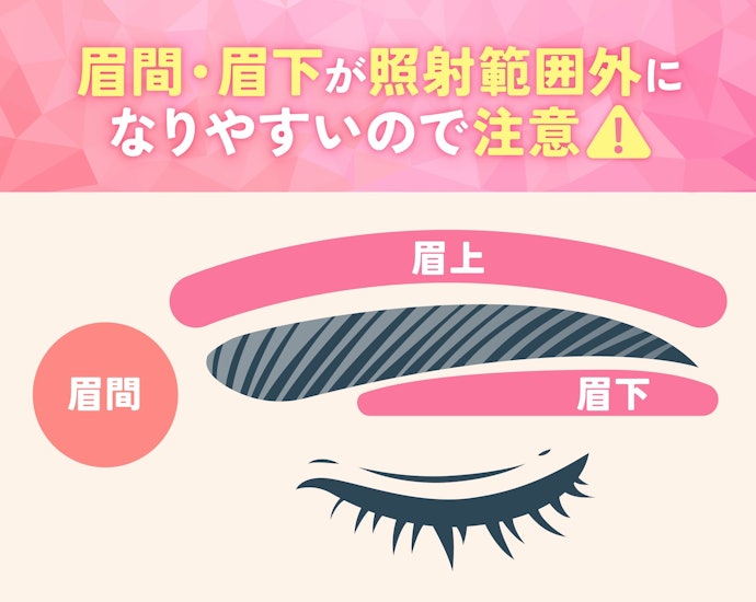 眉毛の照射範囲に、自分が脱毛したい箇所が含まれているかしっかりチェックしよう!