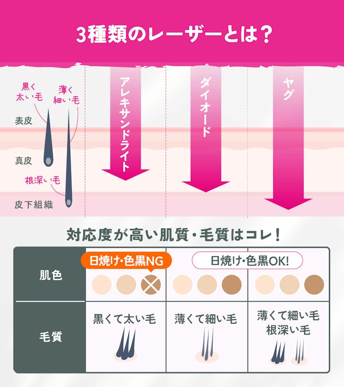 エミナルクリニックの脱毛機・レーザー