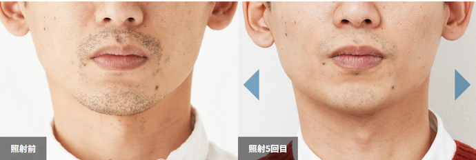 自己処理を楽にしたいなら「5〜6回」が目安