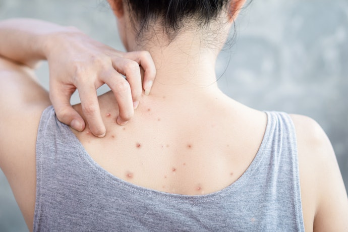 肌荒れ防止・美白効果を期待するなら、プラスαの成分にも注目