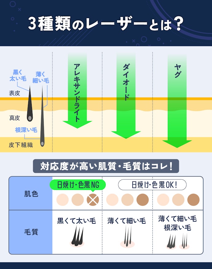 3種類のレーザーが使えるクリニックを選ぼう