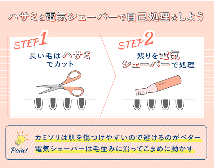 VIO脱毛に行く前のお手入れ方法は?