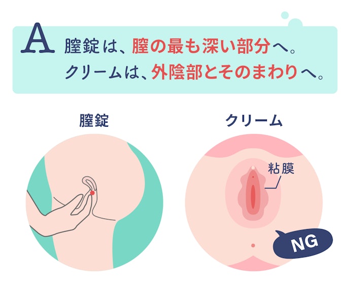 Q. 膣錠はどこに入れたらよい?クリームの塗り方は?