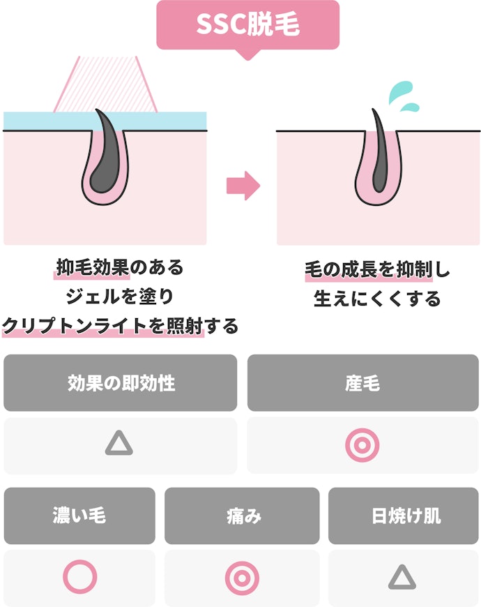 「SSC」は肌のダメージが少なく、痛みを感じにくい