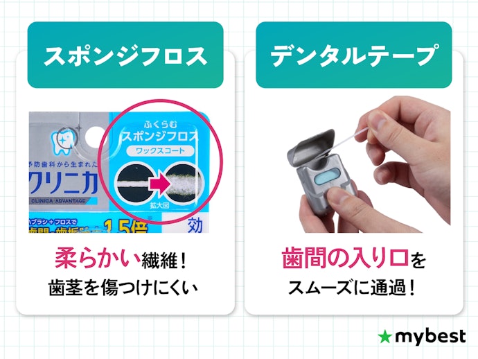 歯間が広めの人は、スポンジタイプやテープタイプを検討しよう