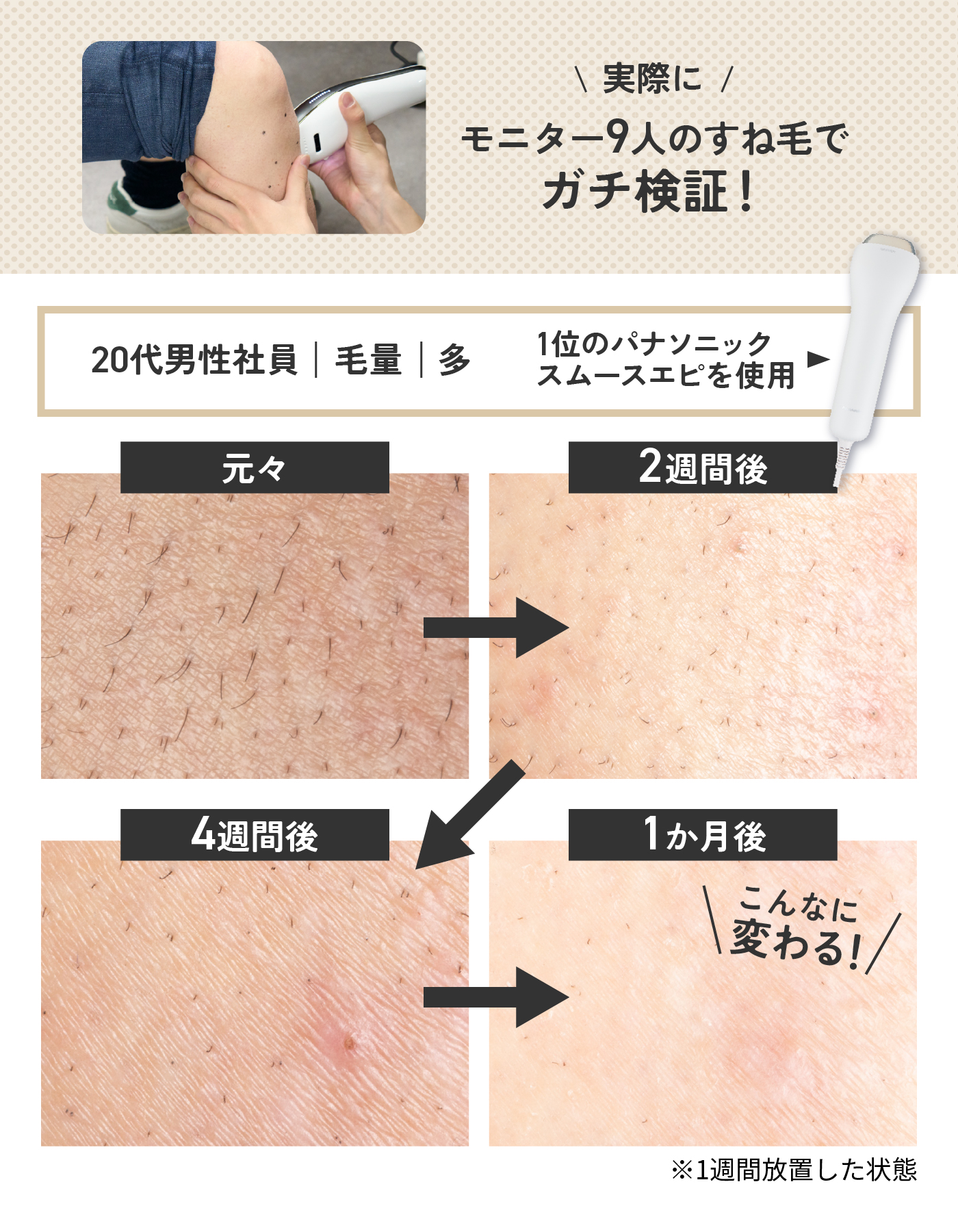 夏のスネ毛、気になる……！ 男性の