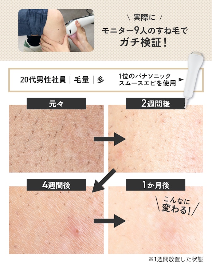 家庭用でも効果はある?男性モニター9人が"週1回×1か月"使ってみた!