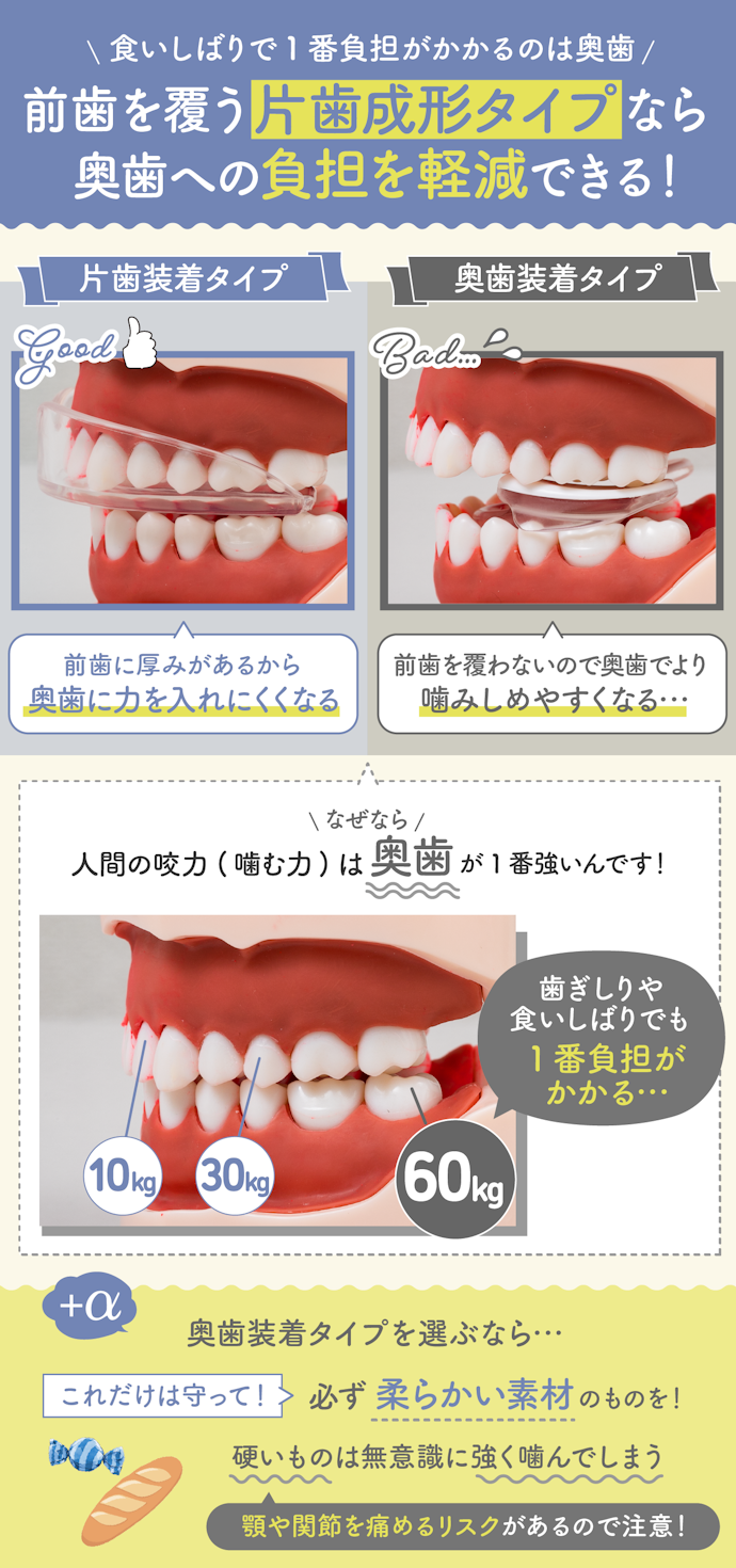 歯ぎしり・食いしばりから歯を守るなら片歯成形タイプ!奥歯装着タイプは避けよう