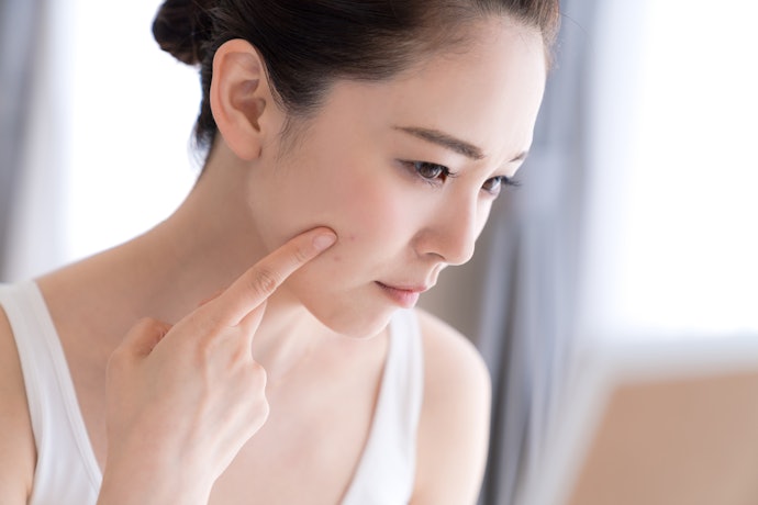 体質から改善したいなら、補助的に漢方薬もチョイス