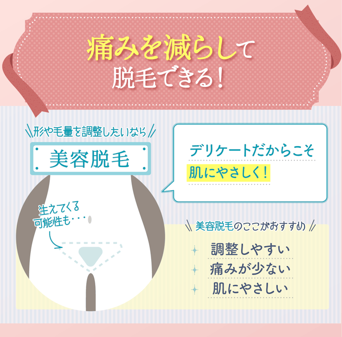 形や毛量の調整がしやすい!痛みが心配なら美容脱毛