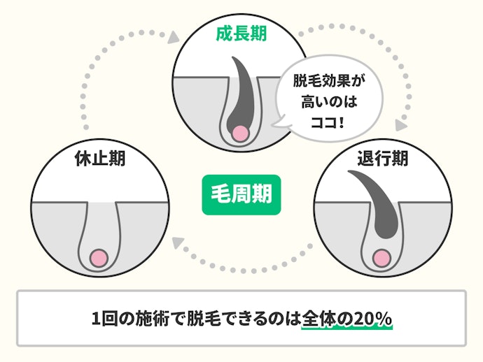 脱毛初期は毛周期に合わせて定期的に通おう。薄くなってきたら間隔をあけてもOK