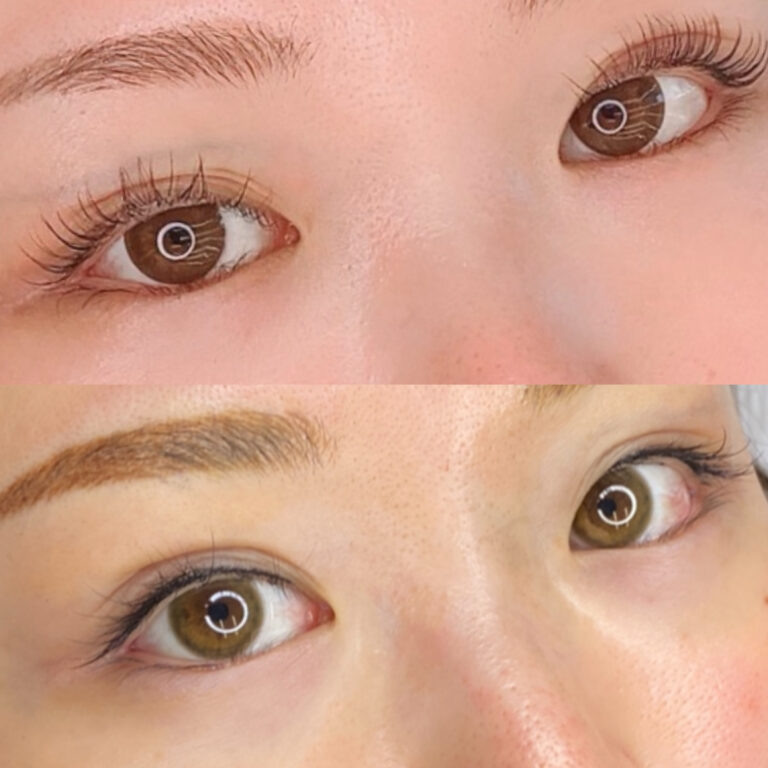 アイラインアートメイクのおすすめクリニック【2025年】 | マイベスト