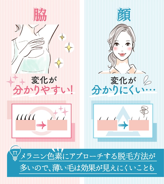 脱毛完了までに回数がかかる