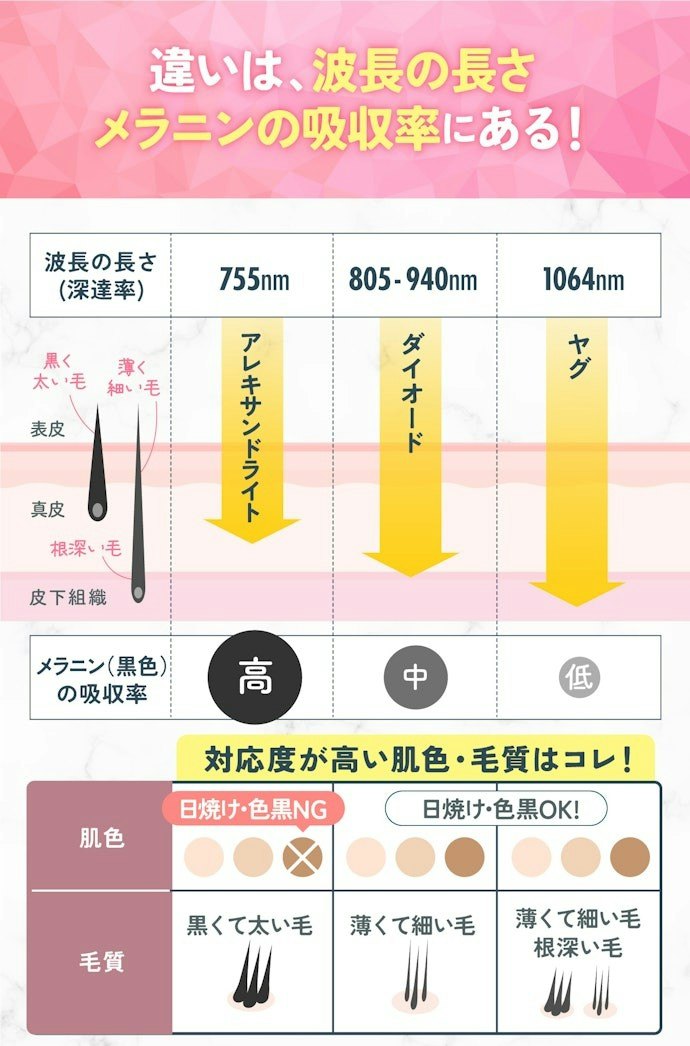 基本はクリニックにお任せでOKだが、自分で選びたい人はレーザーの当て方の違いを理解しよう