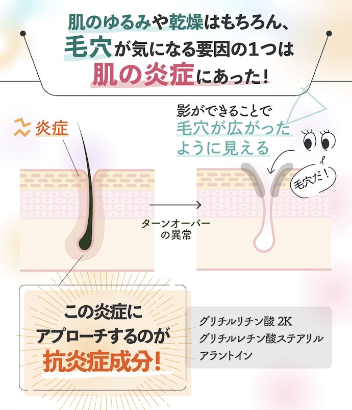 毛穴ケア化粧水を選ぶなら、炎症を抑える整肌成分が入っているかをチェックしよう