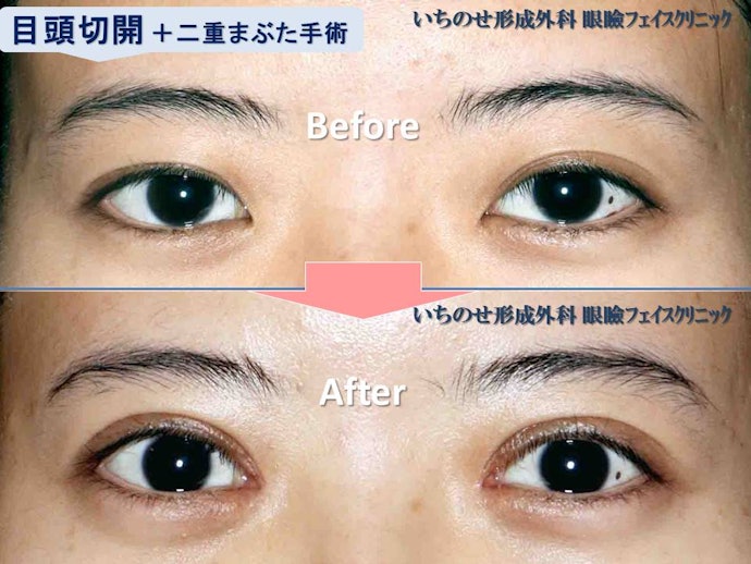 眼形成を専門としている医師がベター。美容外科医歴や症例写真もチェックしよう