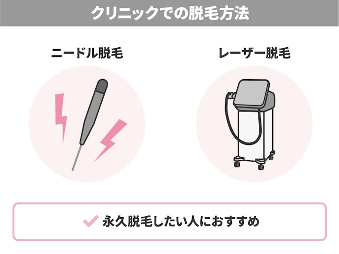 医療脱毛クリニックでは、ニードル脱毛とレーザー脱毛で脱毛が可能