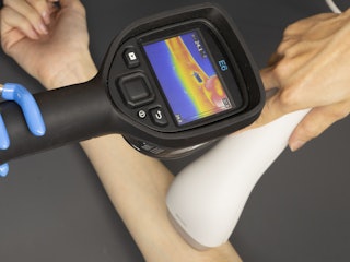 痛みの減らしやすさ