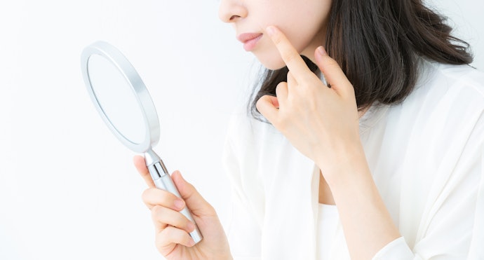 ニキビやシミを防ぎたいなら、有効成分入りの医薬部外品がおすすめ