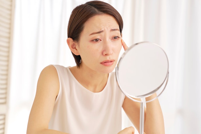 ニキビや肌荒れが発生しやすい人は、肌荒れ防止有効成分に注目