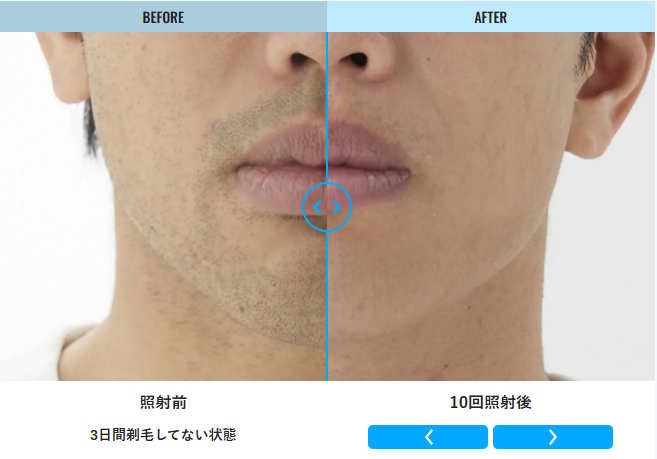 メンズリゼのよい点