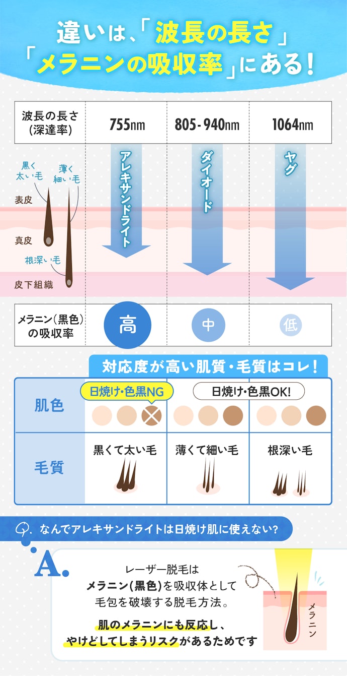 まずは、3種類のレーザーの特徴を確認!それぞれ対応している「肌色」「毛質」が異なる