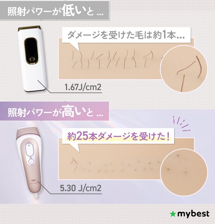 照射パワーの高い家庭用脱毛器がおすすめ