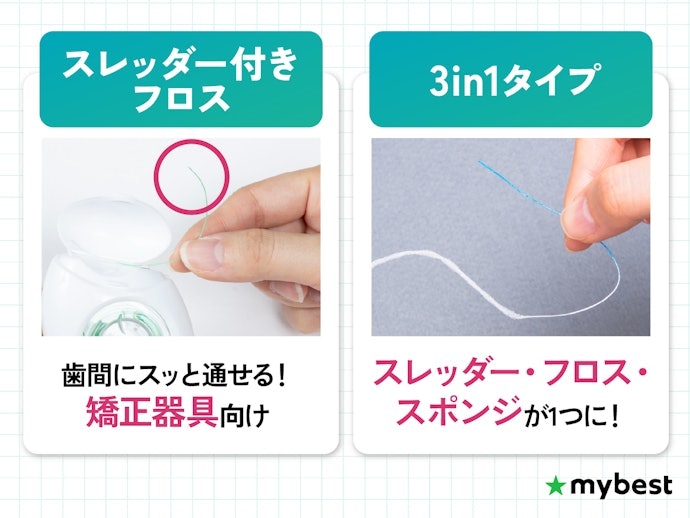 矯正器具・ブリッジ・インプラントには、先端が固くて歯間を差し込みやすいスレッダー付きフロス