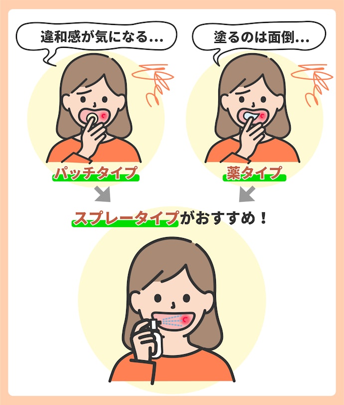 スプレータイプ:パッチや軟膏の違和感が苦手・ワンプッシュで簡単にケアしたい人に