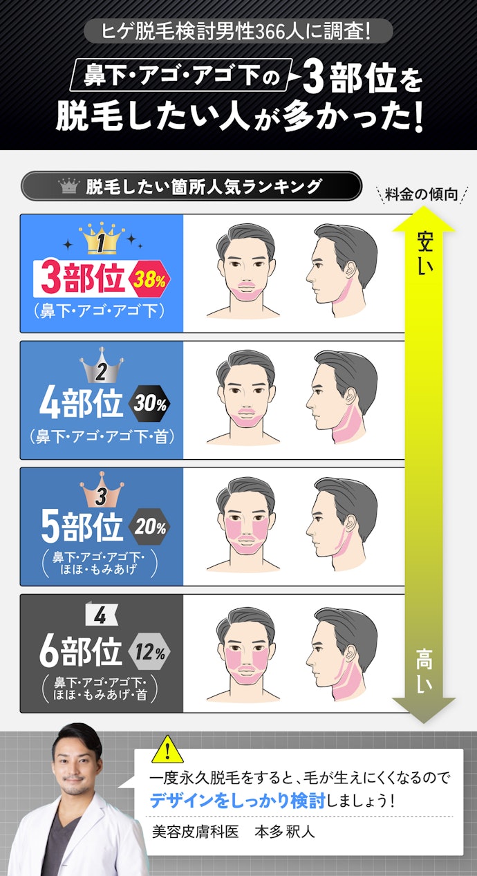 ヒゲの脱毛部位は3部位が一番人気!脱毛したい箇所を再確認しよう