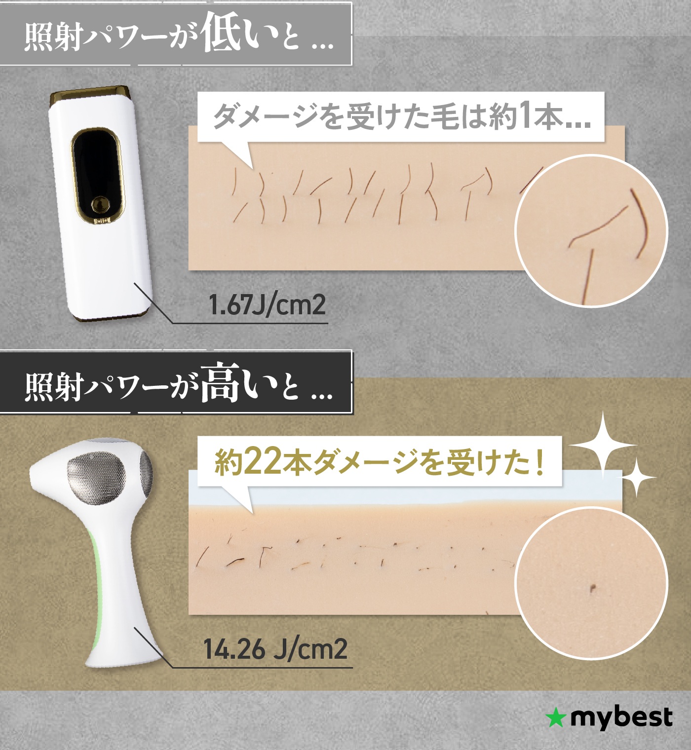 Ulike Air 10 IPL光美容器を検証レビュー！メンズ家庭用脱毛器の