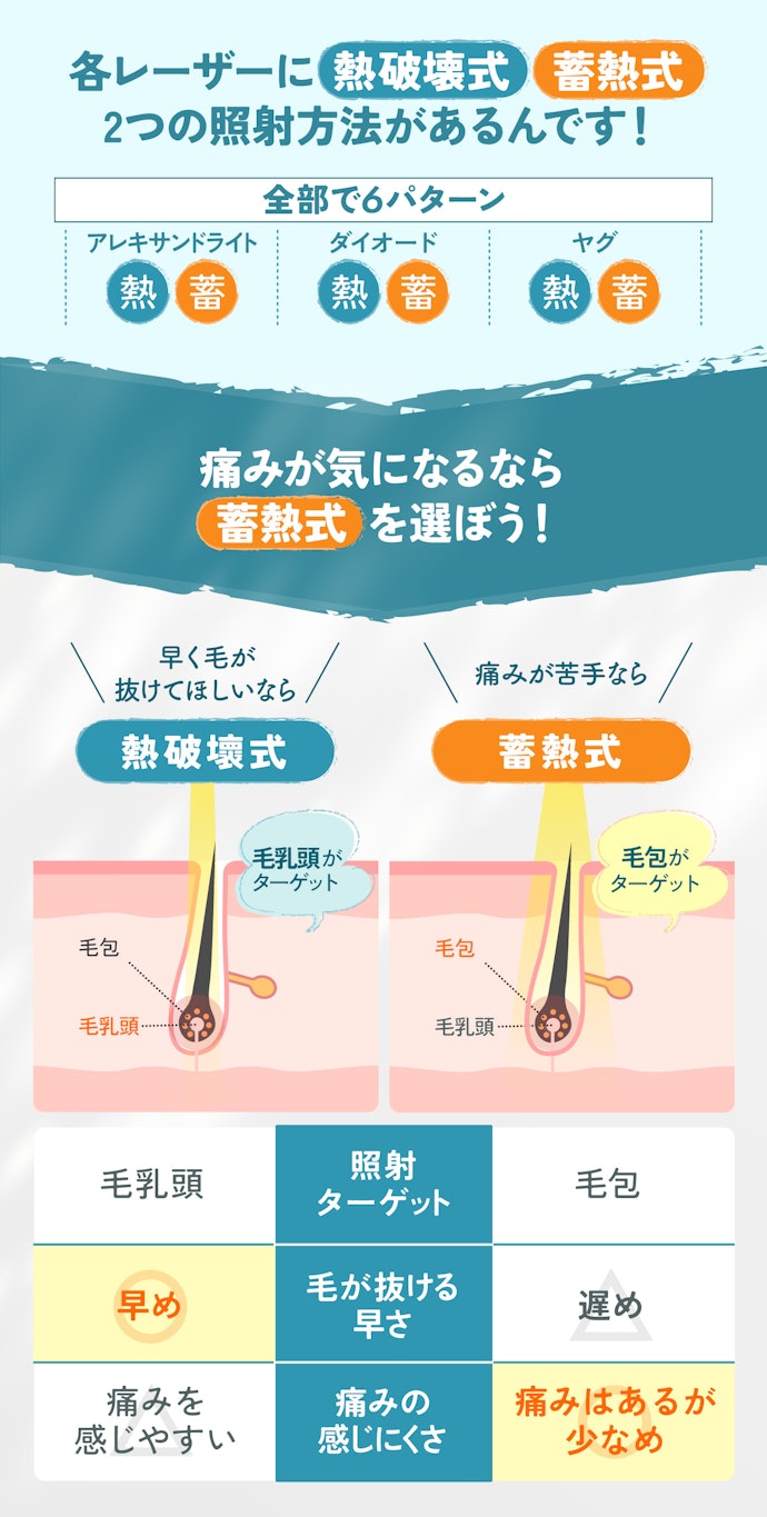レーザーの当て方に違いあり!痛みが心配なら「蓄熱式」もあり