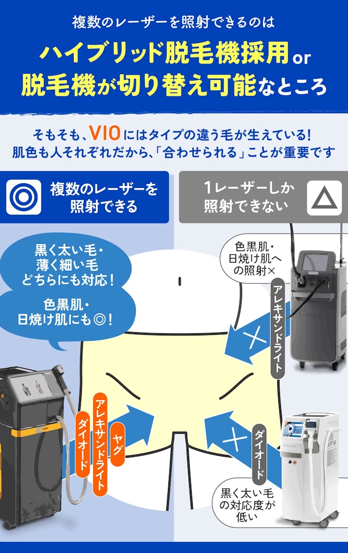 幅広いタイプの毛が生えたVIOの脱毛には「複数のレーザー」を使用して照射するのがベター