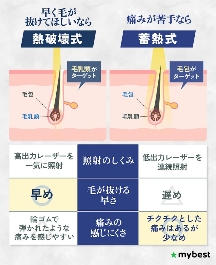 湘南美容クリニックメンズの照射方法は熱破壊式