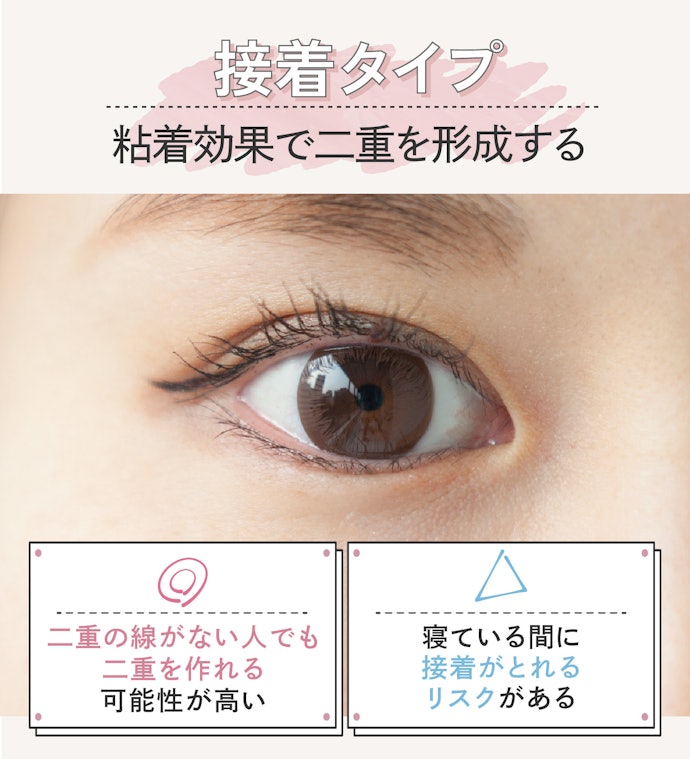 厚ぼったい一重まぶたなら接着タイプを試そう