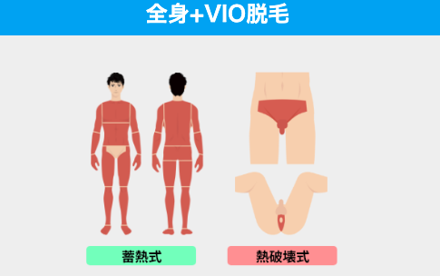 ③全身+VIO脱毛