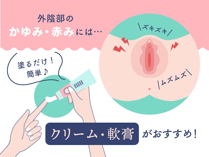 症状が外陰部のみなら、クリーム・軟膏タイプ