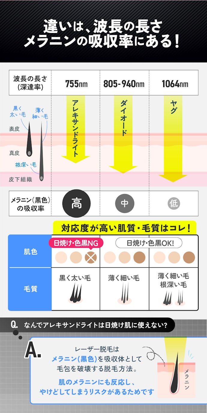 レーザーは主に3種類!各レーザーで対応している「肌色・毛質」が異なる