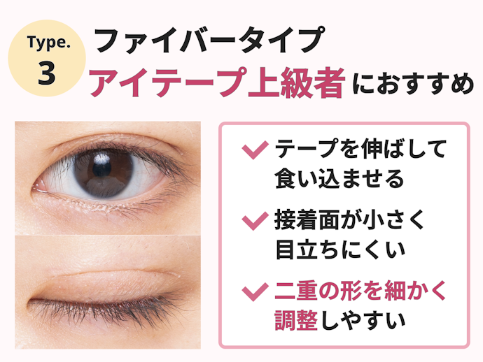 ファイバータイプ:薄いまぶたに